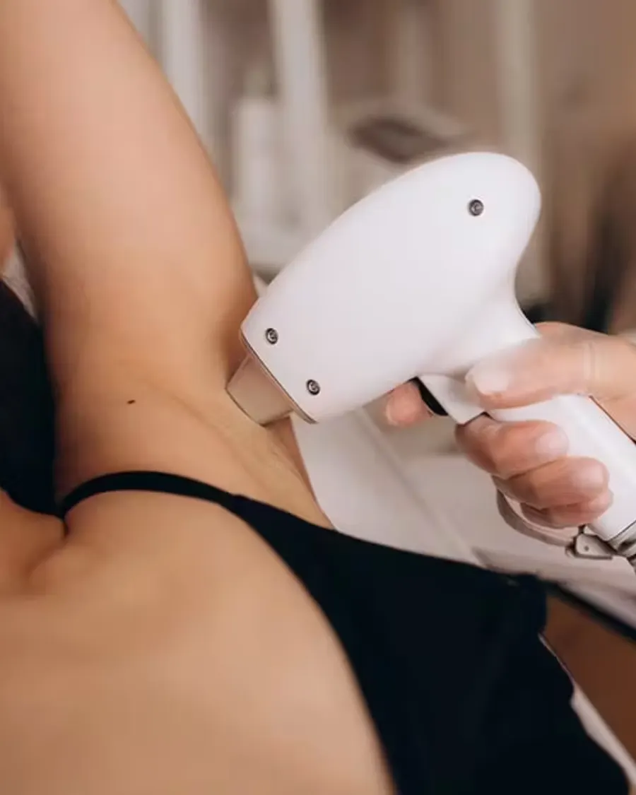 Laser Hair Removal at Cinch Clinics